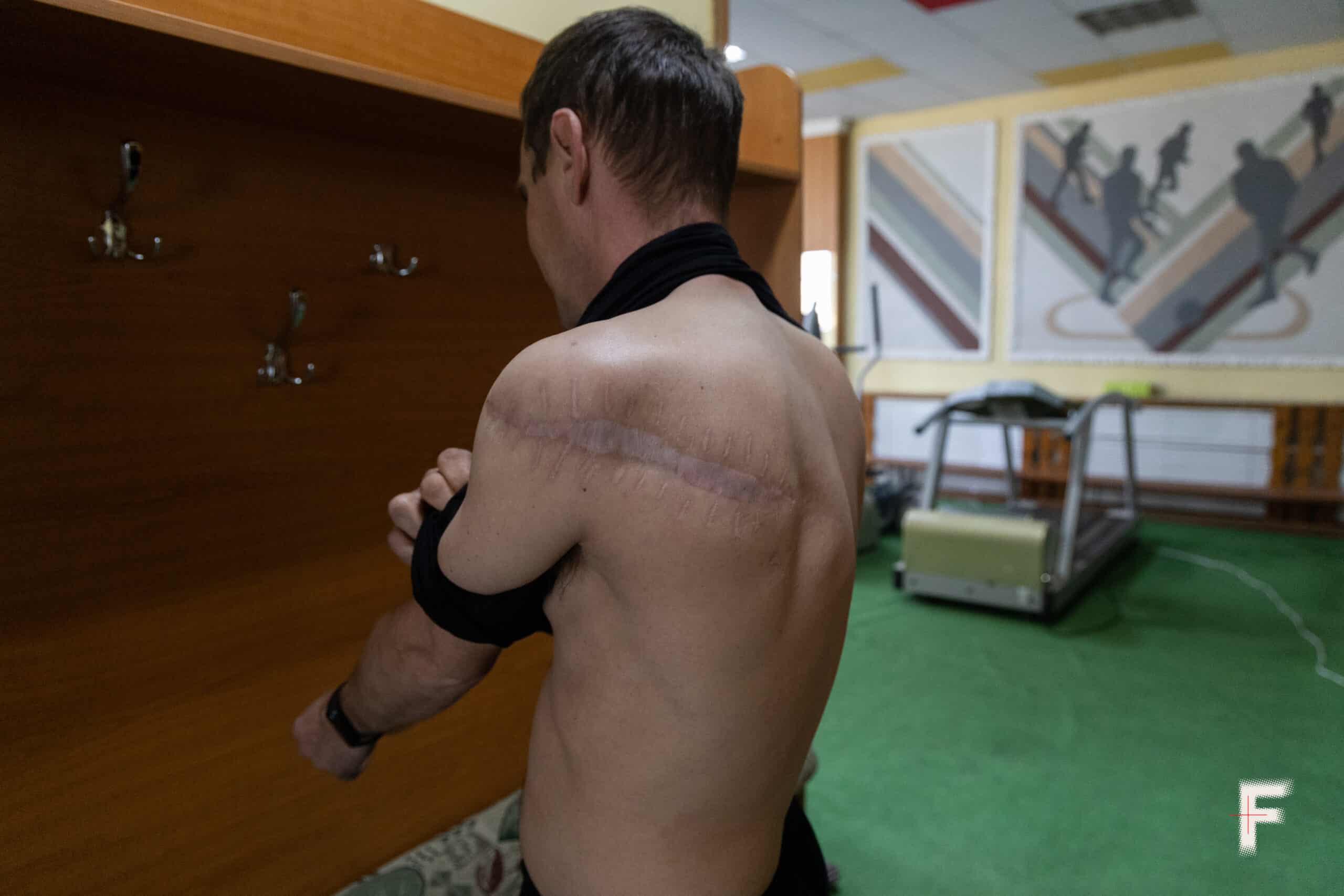 «Постійно снився штурм». Чому не всім військовим доступне психологічне відновлення?