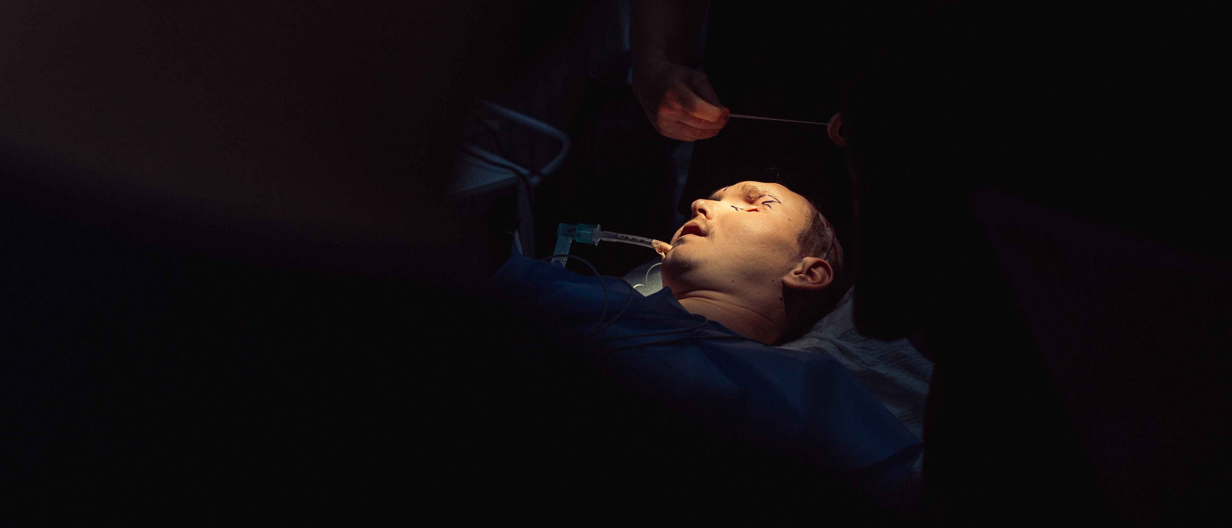 Обличчям до майбутнього: як міжнародна команда хірургів рятує обличчя військовим