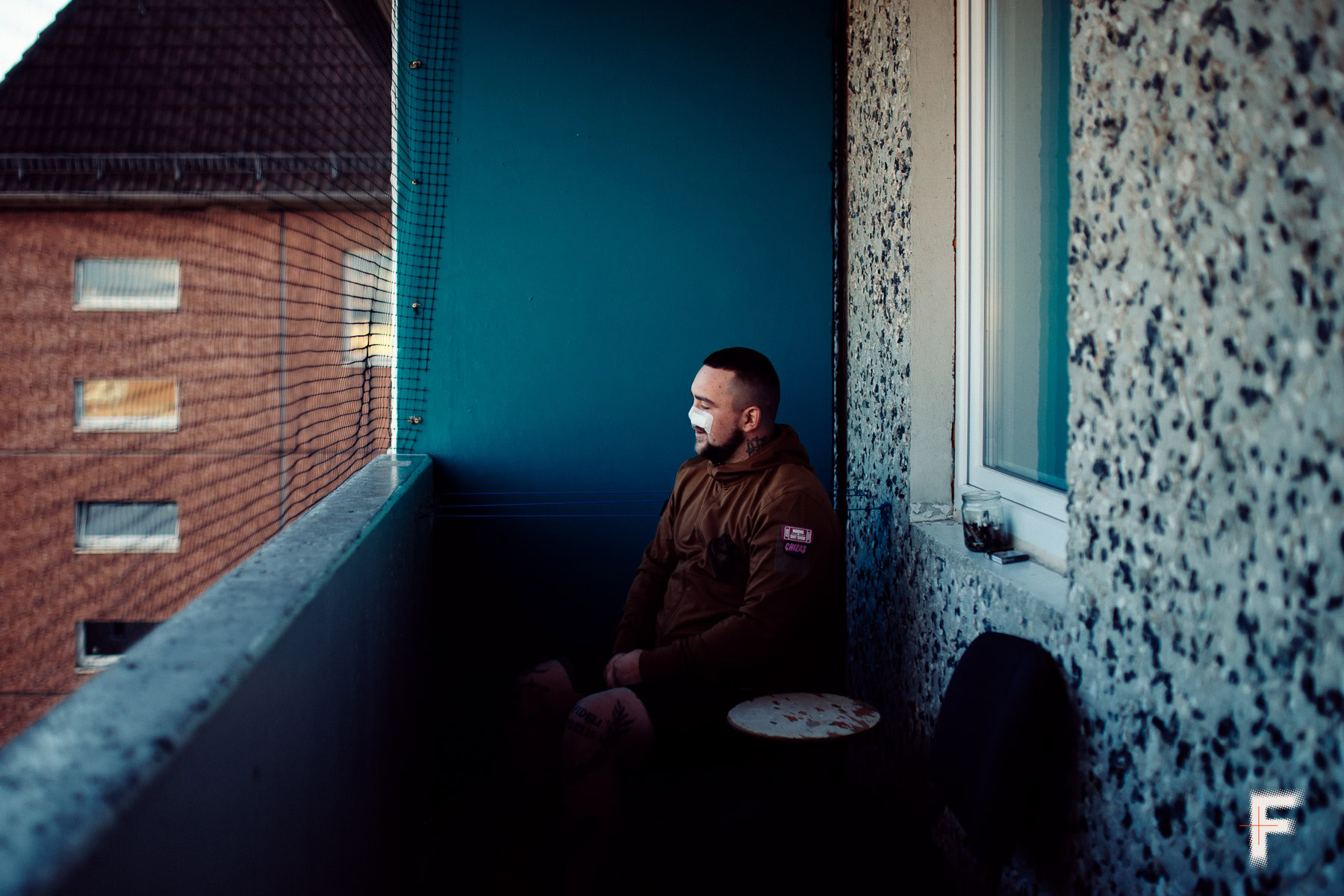 Пацієнт сидить на балконі після операції, з пластирем на носі під час відновлення.