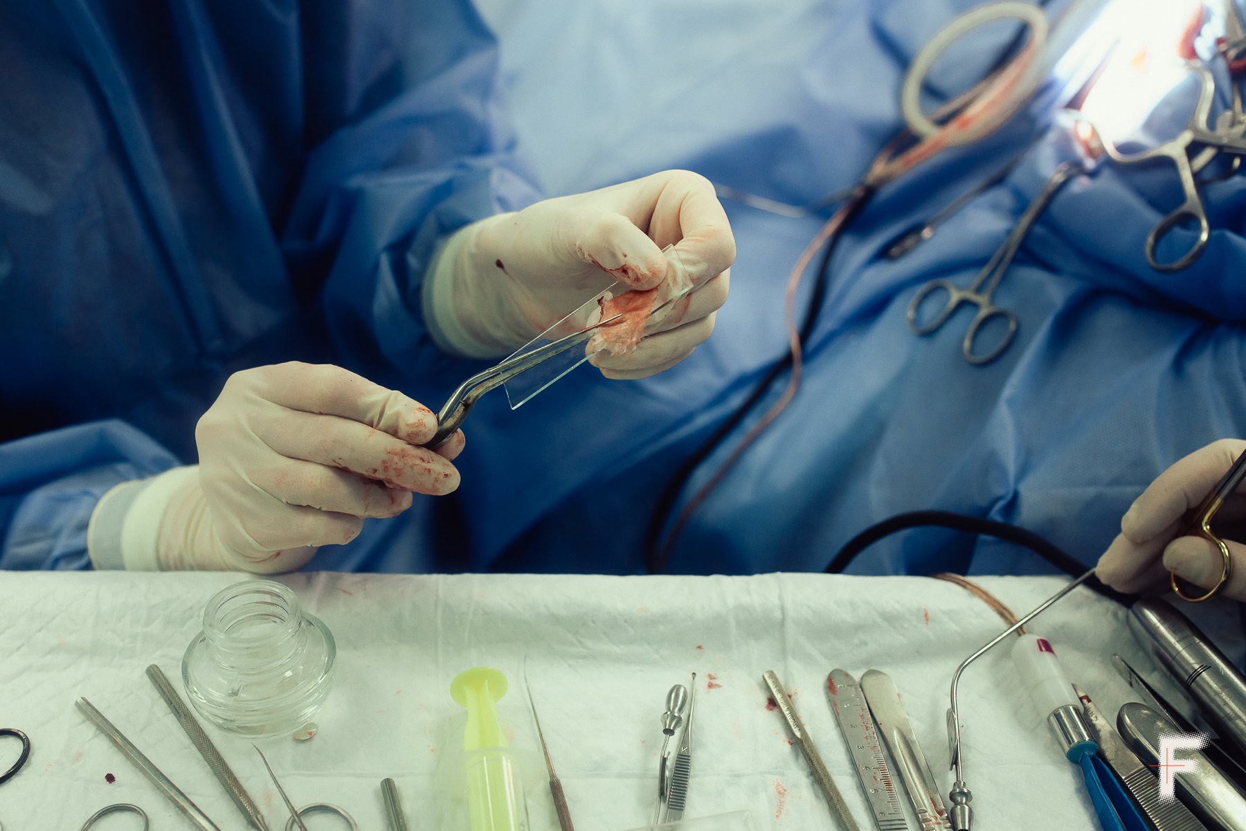 Крупний план рук хірурга, який працює зі слуховою тканиною під час операції.
