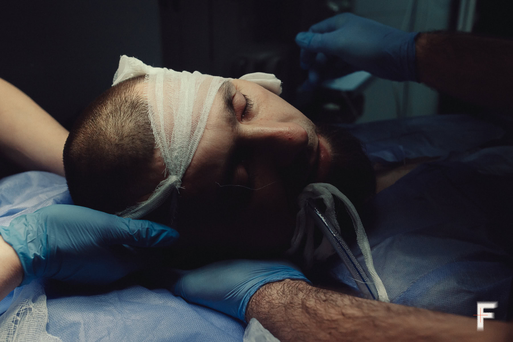 Голову військового бинтують після операції в операційній.