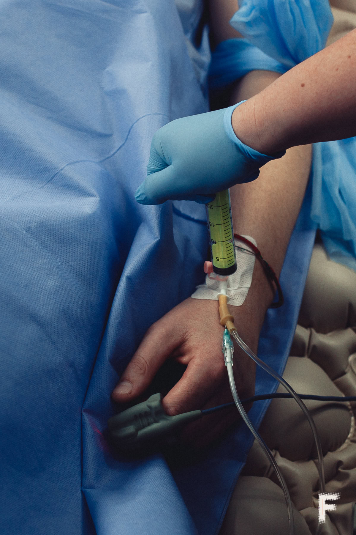 Невидима травма війни: як українські хірурги повертають слух пораненим військовим