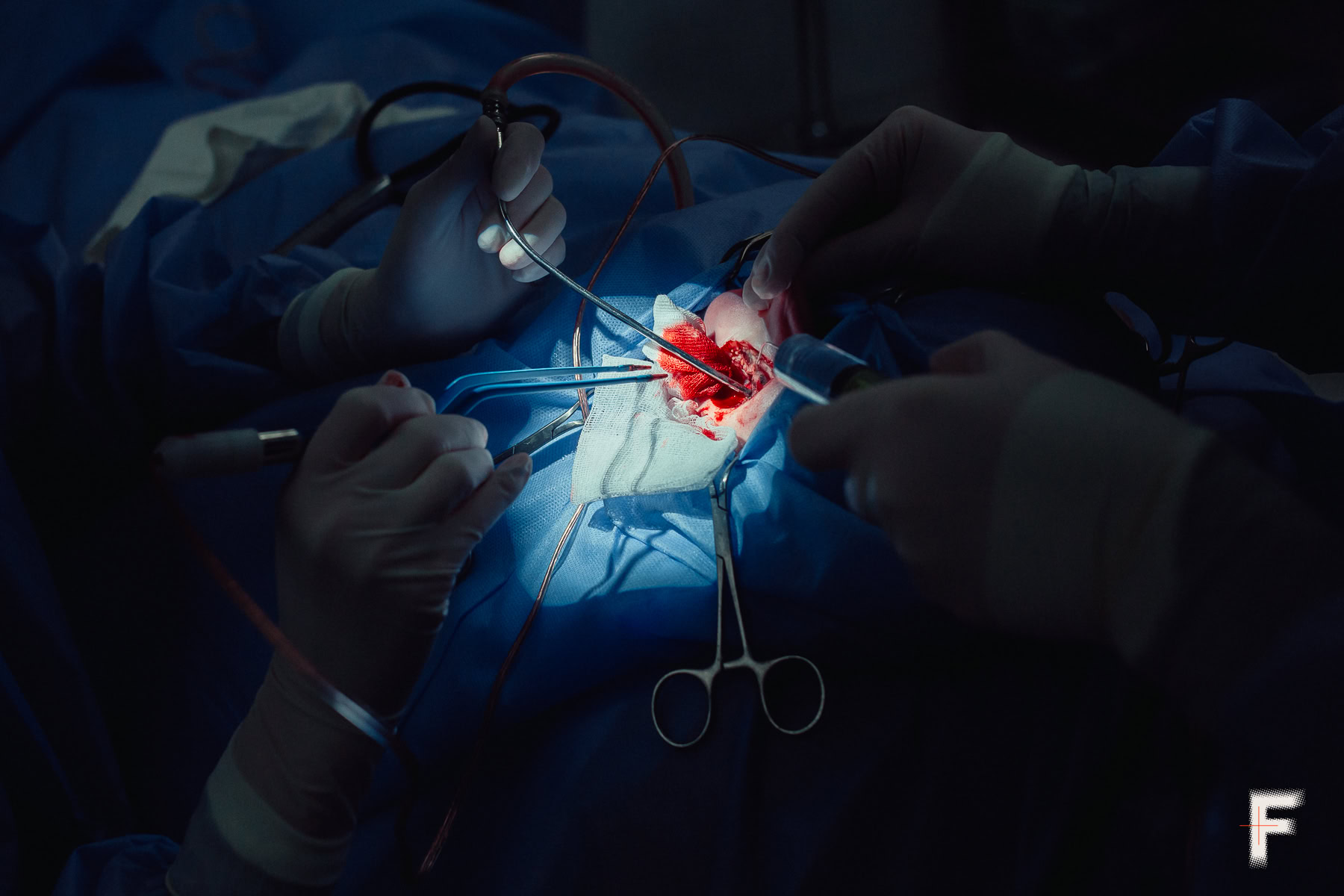 Invisible trauma of war: how Ukrainian surgeons restore hearing to wounded soldiers