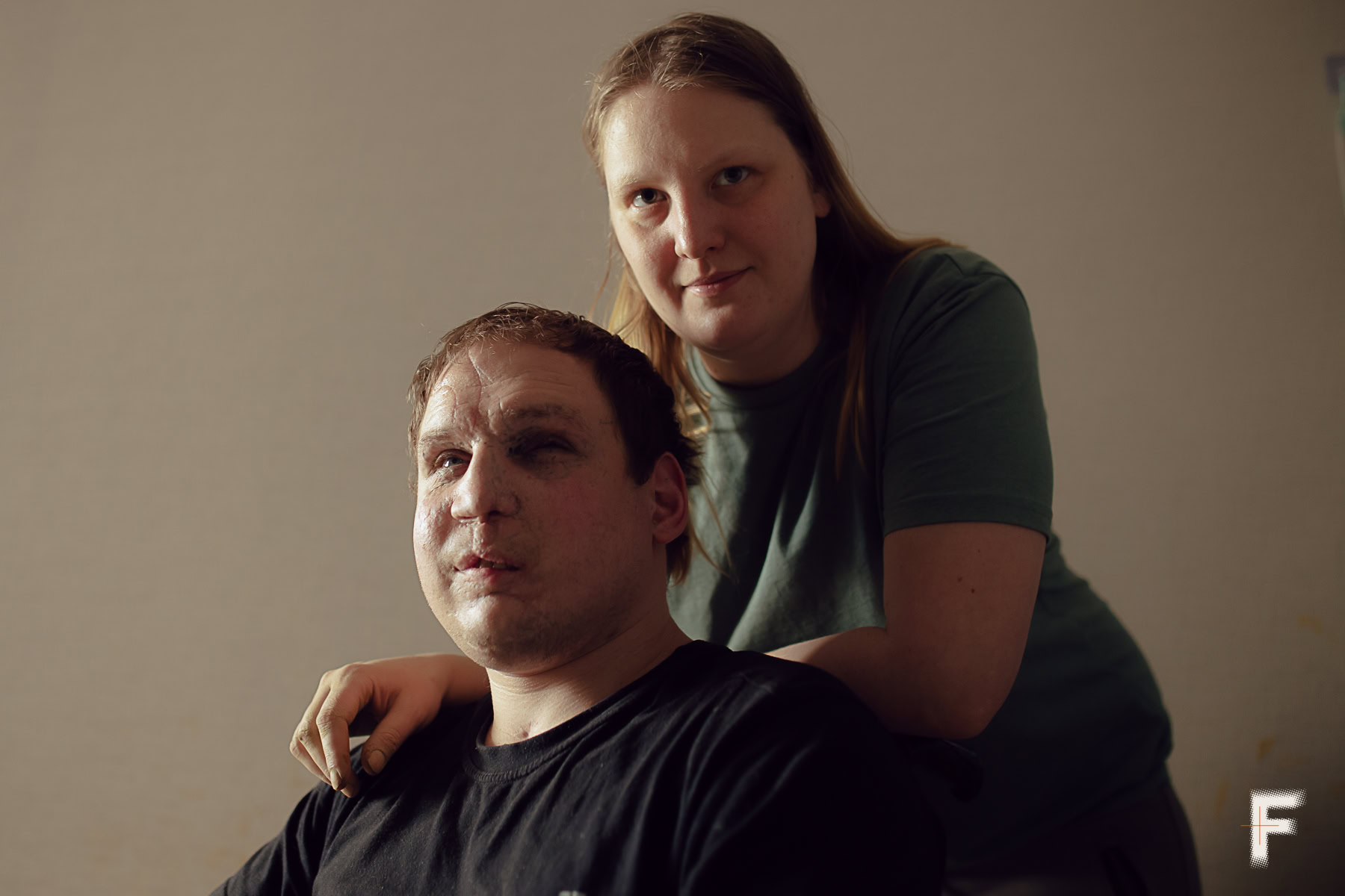 Портрет сліпого ветерана Сергія та його дружини Валерії у їхній домашній майстерні